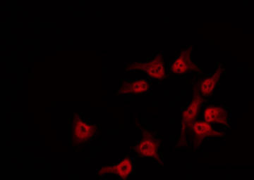 SDCCAG1 / NEMF Antibody - Staining HuvEc cells by IF/ICC. The samples were fixed with PFA and permeabilized in 0.1% Triton X-100, then blocked in 10% serum for 45 min at 25°C. The primary antibody was diluted at 1:200 and incubated with the sample for 1 hour at 37°C. An Alexa Fluor 594 conjugated goat anti-rabbit IgG (H+L) Ab, diluted at 1/600, was used as the secondary antibody.