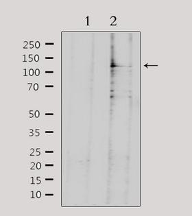 SDCCAG1 / NEMF Antibody - Western blot analysis of extracts of 293 cells using SDCG1 antibody.