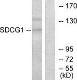 SDCCAG1 / NEMF Antibody - Western blot analysis of extracts from HUVEC cells, using SDCG1 antibody.