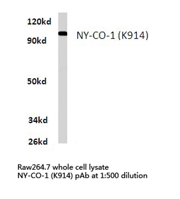 SDCCAG1 / NEMF Antibody - Western blot of NY-CO-1 (K914) pAb in extracts from raw264.7 cells.