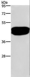 SDCCAG3 Antibody - Western blot analysis of Human prostate tissue, using SDCCAG3 Polyclonal Antibody at dilution of 1:500.