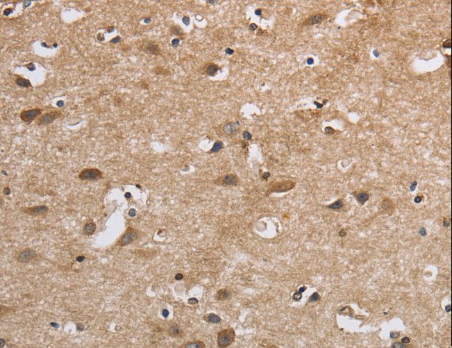 SDCCAG3 Antibody - Immunohistochemistry of paraffin-embedded Human brain using SDCCAG3 Polyclonal Antibody at dilution of 1:30.