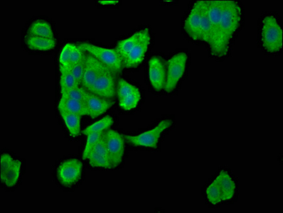 SDCCAG3 Antibody - Immunofluorescence staining of HepG2 cells at a dilution of 1:100, counter-stained with DAPI. The cells were fixed in 4% formaldehyde, permeabilized using 0.2% Triton X-100 and blocked in 10% normal Goat Serum. The cells were then incubated with the antibody overnight at 4 °C.The secondary antibody was Alexa Fluor 488-congugated AffiniPure Goat Anti-Rabbit IgG (H+L) .