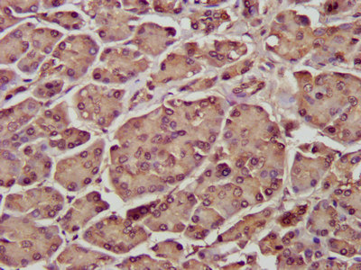 SDCCAG3 Antibody - Immunohistochemistry image at a dilution of 1:300 and staining in paraffin-embedded human pancreatic tissue performed on a Leica BondTM system. After dewaxing and hydration, antigen retrieval was mediated by high pressure in a citrate buffer (pH 6.0) . Section was blocked with 10% normal goat serum 30min at RT. Then primary antibody (1% BSA) was incubated at 4 °C overnight. The primary is detected by a biotinylated secondary antibody and visualized using an HRP conjugated SP system.