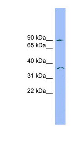 SDCCAG8 Antibody - SDCCAG8 antibody Western blot of THP-1 cell lysate. This image was taken for the unconjugated form of this product. Other forms have not been tested.
