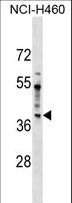 SDCCAG8 Antibody - SDCCAG8 Antibody western blot of NCI-H460 cell line lysates (35 ug/lane). The SDCCAG8 antibody detected the SDCCAG8 protein (arrow).