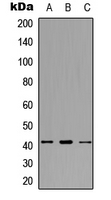 SDCCAG8 Antibody - Western blot analysis of SDCCAG8 expression in HEK293T (A); Raw264.7 (B); H9C2 (C) whole cell lysates.