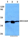 SDCCAG8 Antibody - Western blot of SDCCAG8 antibody at 1:500 dilution. Lane 1: HEK293T whole cell lysate. Lane 2: RAW264.7 whole cell lysate.