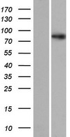 SDCCAG8 Protein - Western validation with an anti-DDK antibody * L: Control HEK293 lysate R: Over-expression lysate
