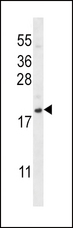 SDF1 / CXCL12 Antibody - CXCL12 Antibody western blot of NCI-H292 cell line lysates (35 ug/lane). The CXCL12 antibody detected the CXCL12 protein (arrow).