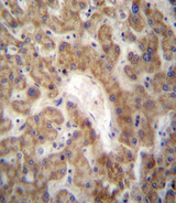 SDF1 / CXCL12 Antibody - CXCL12 Antibody immunohistochemistry of formalin-fixed and paraffin-embedded human liver tissue followed by peroxidase-conjugated secondary antibody and DAB staining.