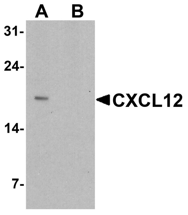 SDF1 / CXCL12 Antibody - Western blot analysis of CXCL12 in HeLa cell lysate with CXCL12 antibody at 1 ug/ml in (A) the absence and (B) the presence of blocking peptide.