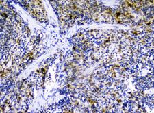 SDF1 / CXCL12 Antibody - IHC analysis of CXCL12 using anti-CXCL12 antibody. CXCL12 was detected in paraffin-embedded section of rat spleen tissues. Heat mediated antigen retrieval was performed in citrate buffer (pH6, epitope retrieval solution) for 20 mins. The tissue section was blocked with 10% goat serum. The tissue section was then incubated with 1µg/ml rabbit anti-CXCL12 Antibody overnight at 4°C. Biotinylated goat anti-rabbit IgG was used as secondary antibody and incubated for 30 minutes at 37°C. The tissue section was developed using Strepavidin-Biotin-Complex (SABC) with DAB as the chromogen.
