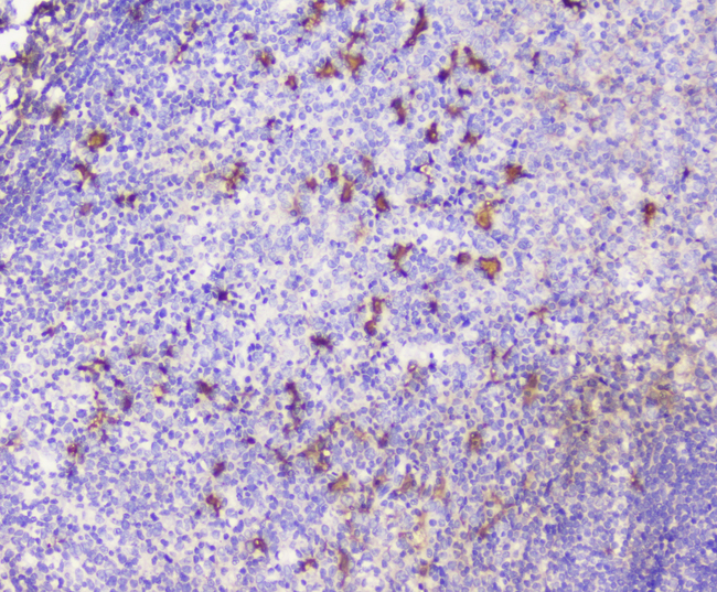 SDF1 / CXCL12 Antibody - IHC analysis of CXCL12 using anti-CXCL12 antibody. CXCL12 was detected in paraffin-embedded section of human tonsil tissue. Heat mediated antigen retrieval was performed in citrate buffer (pH6, epitope retrieval solution) for 20 mins. The tissue section was blocked with 10% goat serum. The tissue section was then incubated with 1µg/ml rabbit anti-CXCL12 Antibody overnight at 4°C. Biotinylated goat anti-rabbit IgG was used as secondary antibody and incubated for 30 minutes at 37°C. The tissue section was developed using Strepavidin-Biotin-Complex (SABC) with DAB as the chromogen.