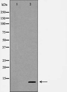 SDF1 / CXCL12 Antibody - Western blot analysis of SDF 1 expression in HepG2 cells. The lane on the left is treated with the antigen-specific peptide.