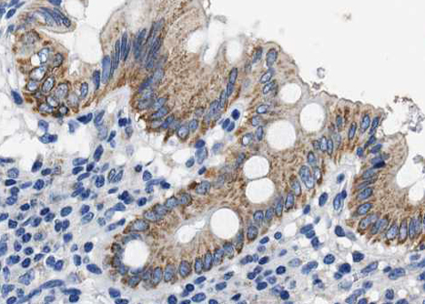 SDF1 / CXCL12 Antibody - 1:100 staining human colon tissue by IHC-P. The tissue was formaldehyde fixed and a heat mediated antigen retrieval step in citrate buffer was performed. The tissue was then blocked and incubated with the antibody for 1.5 hours at 22°C. An HRP conjugated goat anti-rabbit antibody was used as the secondary.