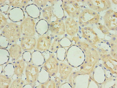 SDF2 Antibody - Immunohistochemistry of paraffin-embedded human kidney tissue using SDF2 Antibody at dilution of 1:100