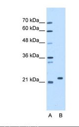 SDF2 Antibody - Lane A: Marker. Lane B: HepG2 cell lysate. Antibody concentration: 1.25 ug/ml. Gel concentration: 12%.  This image was taken for the unconjugated form of this product. Other forms have not been tested.