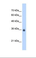 SDF4 Antibody - Jurkat cell lysate. Antibody concentration: 2.5 ug/ml. Gel concentration: 12%.  This image was taken for the unconjugated form of this product. Other forms have not been tested.