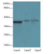 SDF4 Antibody - Western blot. All lanes: SDF4 antibody at 6 ug/ml. Lane 1: U87 whole cell lysate. Lane 2: 293T whole cell lysate. Lane 3: Jurkat whole cell lysate. Secondary antibody: Goat polyclonal to Rabbit IgG at 1:10000 dilution. Predicted band size: 42 kDa. Observed band size: 42 kDa.