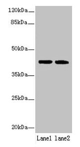 SDF4 Antibody - Western blot All lanes: SDF4 antibody at 6µg/ml Lane 1: U87 whole cell lysate Lane 2: Jurkat whole cell lysate Secondary Goat polyclonal to rabbit IgG at 1/10000 dilution Predicted band size: 42, 31, 28, 24, 16, 40 kDa Observed band size: 42 kDa