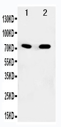 SDHA Antibody - WB of SDHA antibody. All lanes: Anti-SDHA at 0.5ug/ml. Lane 1: Rat Heart Tissue Lysate at 40ug. Lane 2: COLO320 Whole Cell Lysate at 40ug. Predicted bind size: 72KD. Observed bind size: 70KD.