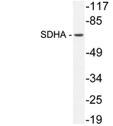 SDHA Antibody - Western blot analysis of lysate from HeLa cells, using SDHA antibody.