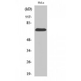 SDHA Antibody - Western blot of SDHA antibody