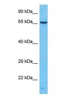 SDHA Antibody - Western blot of SDHA Antibody with human RPMI-8226 Whole Cell lysate.  This image was taken for the unconjugated form of this product. Other forms have not been tested.