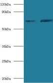 SDHA Antibody - Western blot of Succinate dehydrogenase [ubiquinone] flavoprotein subunit, mitochondrial antibody at 2 ug/ml.  This image was taken for the unconjugated form of this product. Other forms have not been tested.