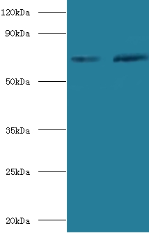 SDHA Antibody - Western blot of Succinate dehydrogenase [ubiquinone] flavoprotein subunit, mitochondrial antibody at 2 ug/ml.  This image was taken for the unconjugated form of this product. Other forms have not been tested.