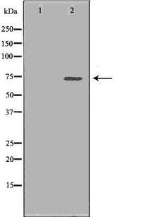 SDHA Antibody - Western blot analysis of HeLa whole cells lysates using SDHA antibody. The lane on the left is treated with the antigen-specific peptide.