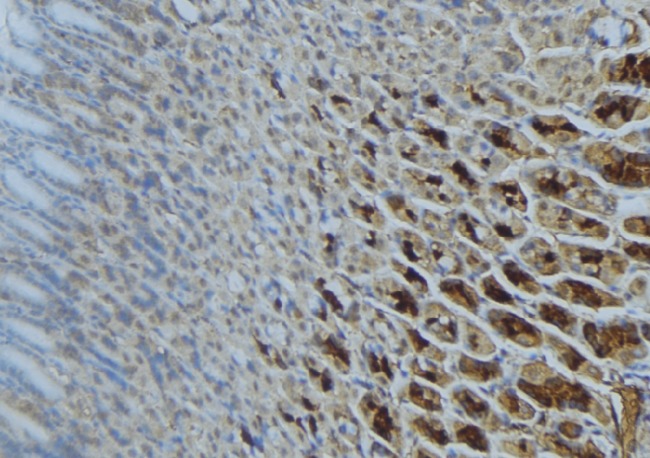 SDHA Antibody - 1:100 staining human gastric tissue by IHC-P. The sample was formaldehyde fixed and a heat mediated antigen retrieval step in citrate buffer was performed. The sample was then blocked and incubated with the antibody for 1.5 hours at 22°C. An HRP conjugated goat anti-rabbit antibody was used as the secondary.