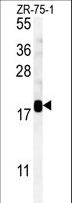 SDHAF1 Antibody - SDHAF1 Antibody western blot of ZR-75-1 cell line lysates (35 ug/lane). The SDHAF1 antibody detected the SDHAF1 protein (arrow).