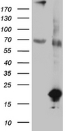 SDHAF1 Antibody - HEK293T cells were transfected with the pCMV6-ENTRY control. (Left lane) or pCMV6-ENTRY SDHAF1. (Right lane) cDNA for 48 hrs and lysed. Equivalent amounts of cell lysates. (5 ug per lane) were separated by SDS-PAGE and immunoblotted with anti-SDHAF1. (1:500)