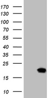 SDHAF1 Antibody - HEK293T cells were transfected with the pCMV6-ENTRY control. (Left lane) or pCMV6-ENTRY SDHAF1. (Right lane) cDNA for 48 hrs and lysed. Equivalent amounts of cell lysates. (5 ug per lane) were separated by SDS-PAGE and immunoblotted with anti-SDHAF1. (1:2000)