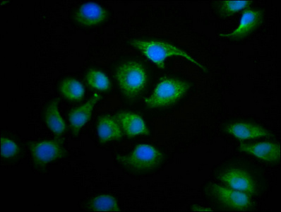 SDHAF2 Antibody - Immunofluorescence staining of A549 cells diluted at 1:100, counter-stained with DAPI. The cells were fixed in 4% formaldehyde, permeabilized using 0.2% Triton X-100 and blocked in 10% normal Goat Serum. The cells were then incubated with the antibody overnight at 4°C.The Secondary antibody was Alexa Fluor 488-congugated AffiniPure Goat Anti-Rabbit IgG (H+L).