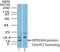 SDHAF4 Antibody - Western blot of UPF0369 protein C6orf57 homolog in mouse embryo body tissue lysates in the 1) absence and 2) presence of immunizing peptide using Polyclonal Antibody to UPF0369 protein C6orf57 homolog at6 ug/ml. Goat anti-rabbit Ig HRP secondary antibody, and PicoTect ECL substrate solution were used for this test.