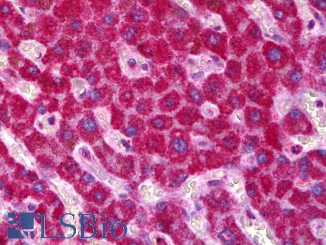 SDHB Antibody - Anti-SDHB antibody IHC of human liver. Immunohistochemistry of formalin-fixed, paraffin-embedded tissue after heat-induced antigen retrieval. Antibody dilution 1:100.  This image was taken for the unconjugated form of this product. Other forms have not been tested.