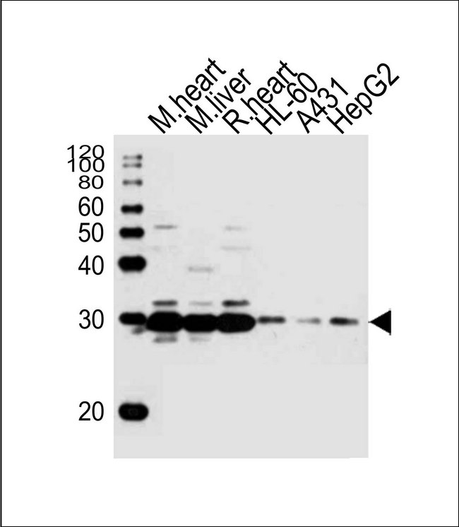 SDHB Antibody - Western blot of lysates from mouse heart, mouse liver, rat heart tissue, HL-60, A431, HepG2 cell line (from left to right) with (DANRE) sdhb Antibody. Antibody was diluted at 1:1000 at each lane. A goat anti-rabbit IgG H&L (HRP) at 1:10000 dilution was used as the secondary antibody.