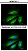 SDHB Antibody - Immunofluorescence of methanol-fixed HeLa using SDHB antibody at 1:200 dilution.