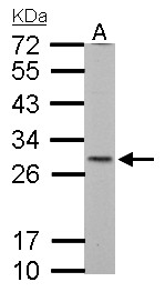 SDHB Antibody - SDHB antibody [C2C3], C-term detects SDHB protein by Western blot analysis. A. 30 ug Neuro2A whole cell lysate/extract. 12 % SDS-PAGE. SDHB antibody [C2C3], C-term dilution:1:1000