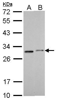 SDHB Antibody - SDHB antibody [C2C3], C-term detects SDHB protein by Western blot analysis. A. 30 ug THP-1 whole cell lysate/extract. B. 30 ug NCI-H929 whole cell lysate/extract. 12 % SDS-PAGE. SDHB antibody [C2C3], C-term dilution:1:1000