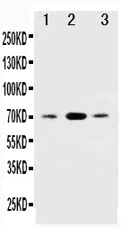 SDHB Antibody - WB of SDHB antibody. All lanes: Anti-SDHB at 0.5ug/ml. Lane 1: Rat Testis Tissue Lysate at 40ug. Lane 2: Rat Cardiac Muscle Tissue Lysate at 40ug. Lane 3: JURKAT Whole Cell Lysate at 40ug. Predicted bind size: 70KD. Observed bind size: 70KD.