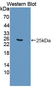 SDHB Antibody - Western blot of SDHB antibody.