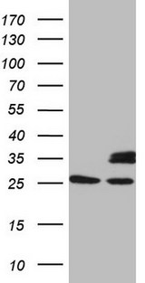 SDHB Antibody - HEK293T cells were transfected with the pCMV6-ENTRY control. (Left lane) or pCMV6-ENTRY SDHB. (Right lane) cDNA for 48 hrs and lysed. Equivalent amounts of cell lysates. (5 ug per lane) were separated by SDS-PAGE and immunoblotted with anti-SDHB. (1:2000)