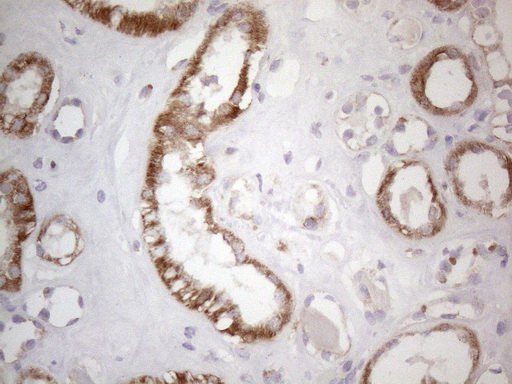 SDHB Antibody - Immunohistochemical staining of paraffin-embedded Human Kidney tissue within the normal limits using anti-SDHB mouse monoclonal antibody. (Heat-induced epitope retrieval by 1mM EDTA in 10mM Tris buffer. (pH8.5) at 120°C for 3 min. (1:150)