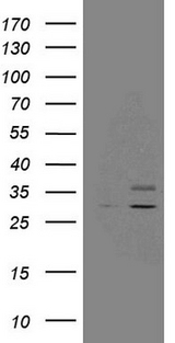 SDHB Antibody - HEK293T cells were transfected with the pCMV6-ENTRY control. (Left lane) or pCMV6-ENTRY SDHB. (Right lane) cDNA for 48 hrs and lysed. Equivalent amounts of cell lysates. (5 ug per lane) were separated by SDS-PAGE and immunoblotted with anti-SDHB. (1:500)