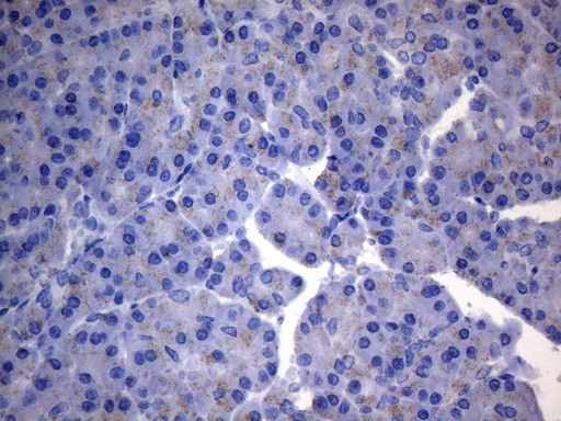 SDHB Antibody - Immunohistochemical staining of paraffin-embedded Human pancreas tissue within the normal limits using anti-SDHB mouse monoclonal antibody. (Heat-induced epitope retrieval by 1mM EDTA in 10mM Tris buffer. (pH8.5) at 120°C for 3 min. (1:150)