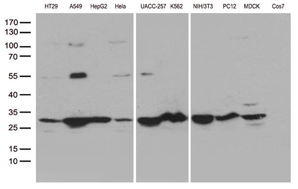 SDHB Antibody - Western blot analysis of extracts. (35ug) from 10 different cell lines by using anti-SDHB monoclonal antibody. 1:500